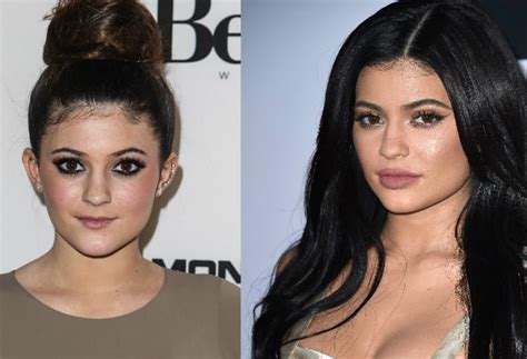 15 celebs who have opened up about having had plastic surgery.